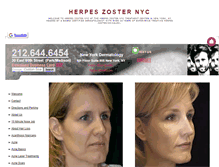 Tablet Screenshot of herpeszosternyc.org